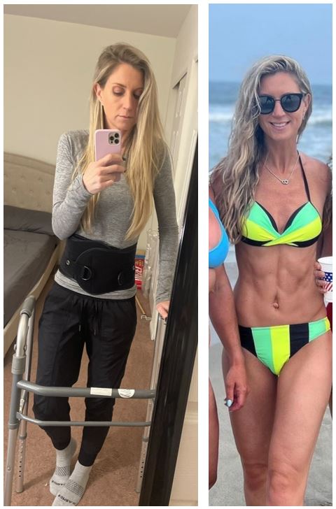 Alysson Annunziata - before and after