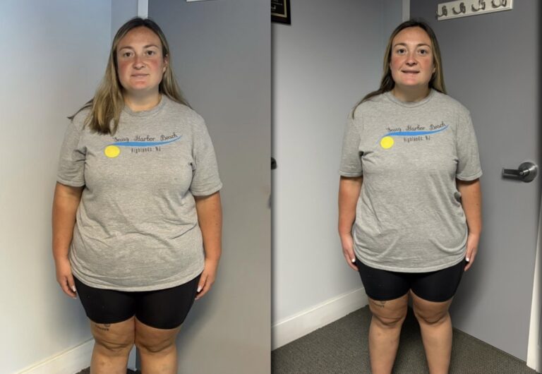 Colleen Snow before & after