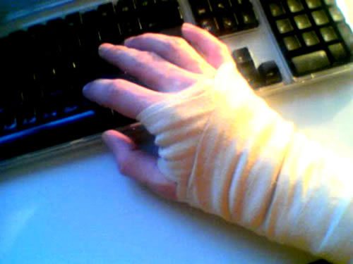 carpal_tunnel_syndrome_-eastpointe-healthcare-news
